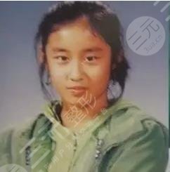 T-ara樸智妍整容過(guò)嗎?