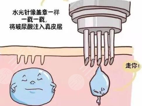 注射了水光補水皮膚變好了 水光補水注射后注意事項