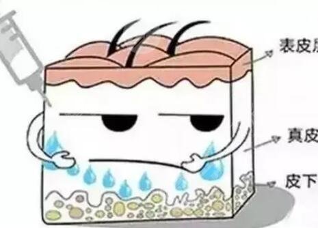 注射了水光補水皮膚變好了 水光補水注射后注意事項