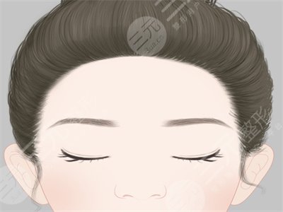 玻尿酸填充,去除法令紋