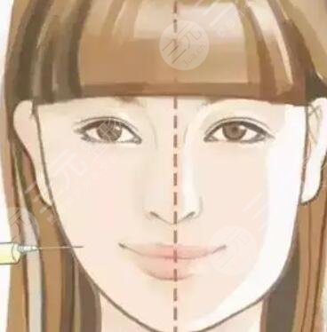 內(nèi)雙,怎么變,外雙,看看,我的,手術(shù),恢復(fù),過程