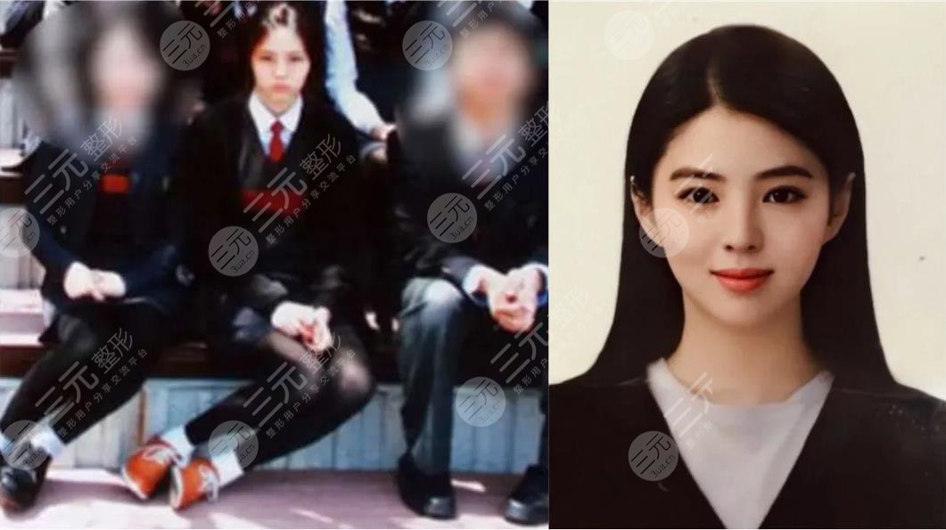 韓素希整容過嗎?