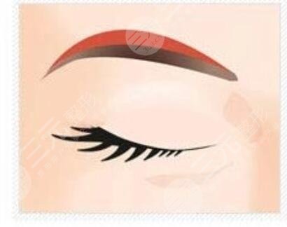 切眉手術(shù)1-7天的前后對比圖，恢復(fù)過程沒有什么后遺癥出現(xiàn)