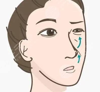 成都素美李建剛隆鼻果怎么樣？附案例真實(shí)反饋