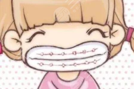 地包天矯正前后對比照片