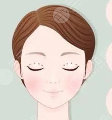 北京聯(lián)合麗格雙眼皮案例：恢復(fù)得很自然，還會放電~