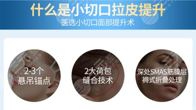 拉皮手術需要多少錢？