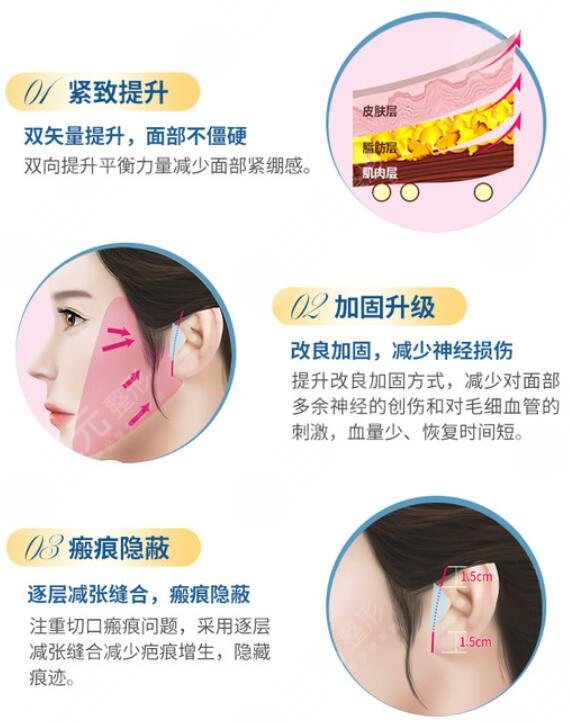 小切口拉皮除皺術怎么樣?
