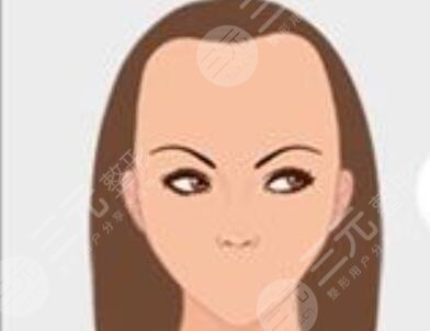 劉裴華植發(fā)案例