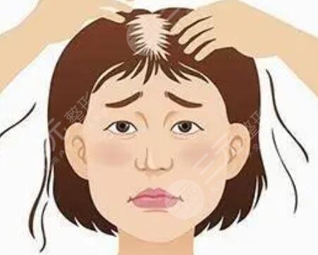 南寧貞韓植發(fā)醫(yī)院案例