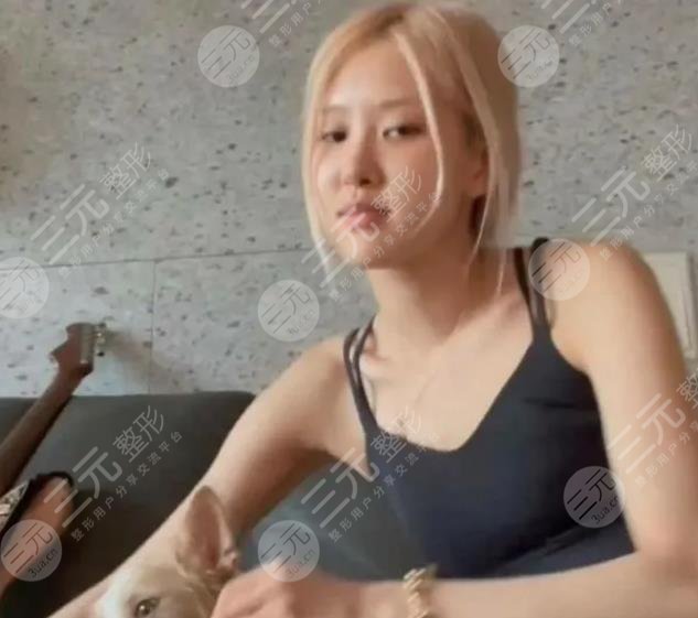 樸彩英整容變美經(jīng)過歷程：