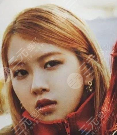 樸彩英整容變美經(jīng)過歷程：