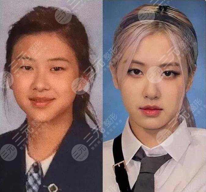 BLACKPINK樸彩英整容實錘了？舊照曝光對比現(xiàn)在大變臉！粉絲卻不認？