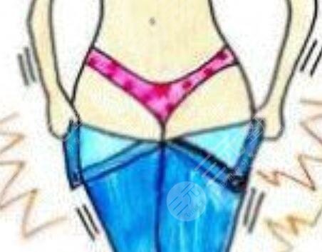 5g光雕吸脂手術(shù)記錄