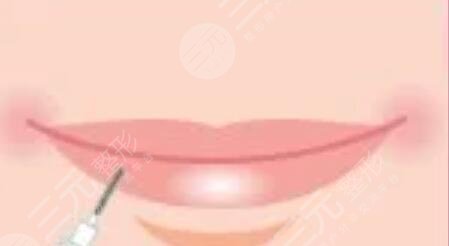 漂唇恢復(fù)七天過程圖，附個(gè)人漂唇經(jīng)歷過程圖片