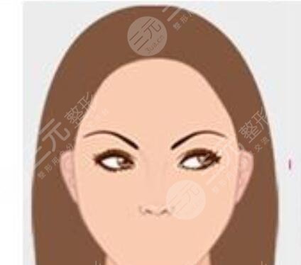 寧波美萊植發(fā)靠譜嗎？附美萊發(fā)際線種植手術(shù)經(jīng)歷分享