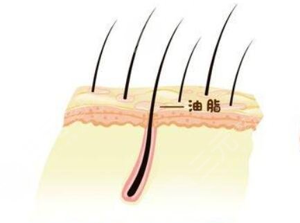 南寧大麥微針植發(fā)怎么樣？附醫(yī)生介紹+禿頂加密種植手術(shù)經(jīng)歷分享
