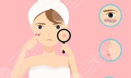 鄭州歐華整形價(jià)格表|像素激光痘印真實(shí)果圖祛痘案例