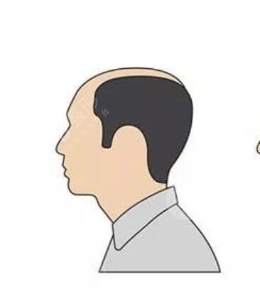 蘇州薇琳植發(fā)醫(yī)院醫(yī)生介紹