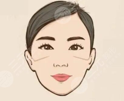 武漢新至美整形價格表|隆下頜真實案例立現鵝蛋臉