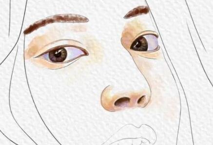 塌鼻子隆鼻前后圖片|真實案例分享：隆鼻之前