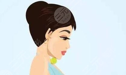 塌鼻子隆鼻;手術(shù)之后的三個月