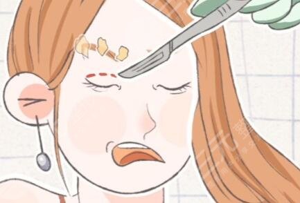 美瞳線一到七天恢復(fù)過(guò)程圖：七天左右