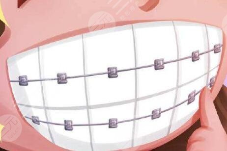 北京協(xié)和醫(yī)院種植牙怎么樣？附我的種植牙過程及術后果