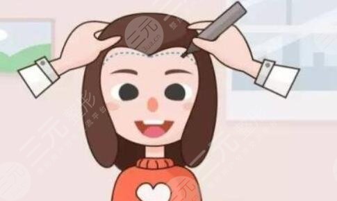 武漢熙朵植發(fā)靠譜嗎？種發(fā)際線果怎么樣？附種植后恢復(fù)圖