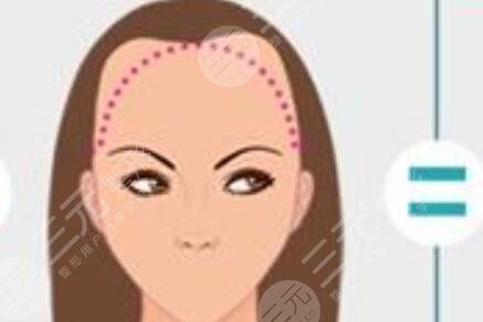 武漢熙朵植發(fā)醫(yī)院醫(yī)生