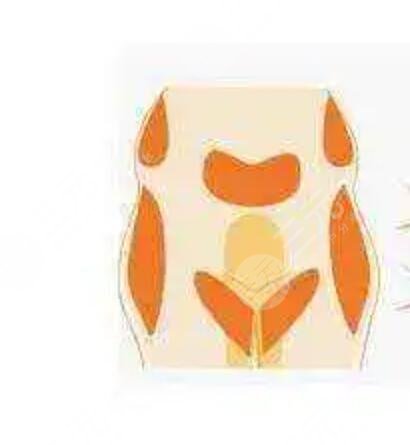 張一鳴個(gè)人資料簡介，附上玻尿酸填充案例