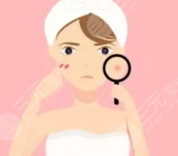 火鳳凰面部溶脂果圖