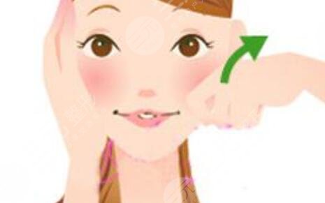 面部吸脂恢復過程