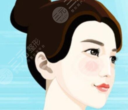 耳軟骨墊鼻尖術(shù)前