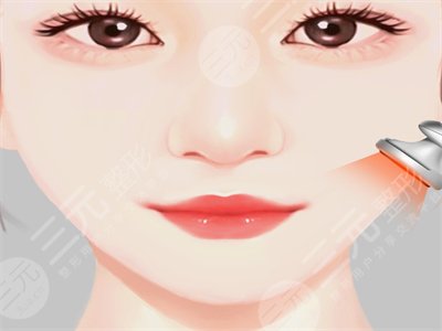 面部溶脂前后照片對比，3個月恢復(fù)正常！