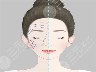 新一代熱瑪吉果會(huì)產(chǎn)生怎樣的“神奇功”?