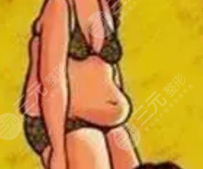 長(zhǎng)沙素妍整形價(jià)格表|吸脂瘦腿案例分享立現(xiàn)筷子腿