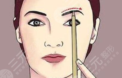 激光洗眉十天后照片，恢復(fù)全過程記錄