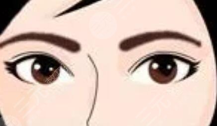 激光洗眉一到七天變化很明X！告別過時，做漂亮美眉！