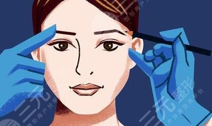 華西卿勇整形失敗雙眼皮修復當天