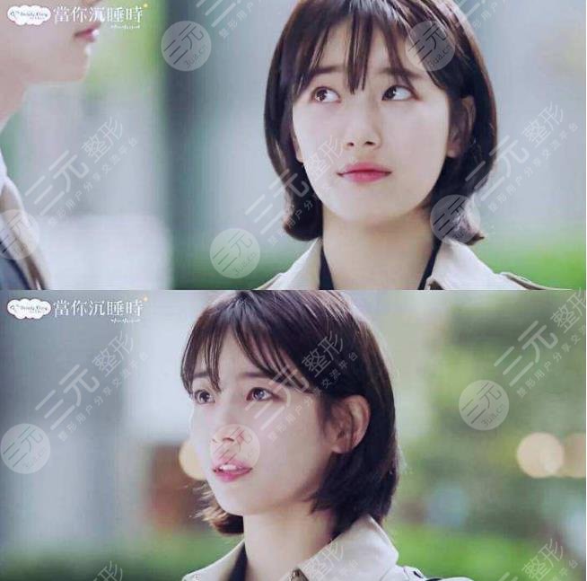 裴秀智微整泡到李敏鎬！從土氣女孩到韓劇女主？她動(dòng)了哪些地方？