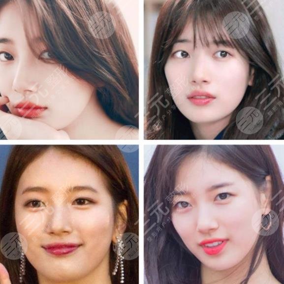 【裴秀智整容了嗎】