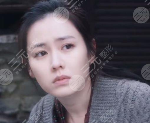 孫藝珍顏值有缺陷嗎?