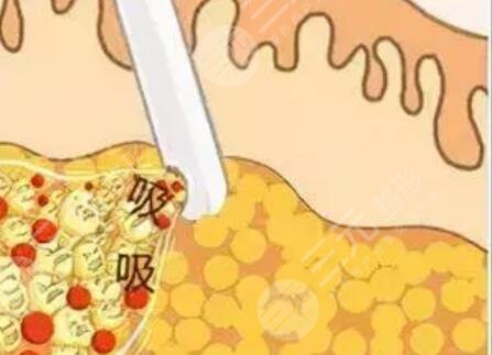 延吉金光善整形醫(yī)院