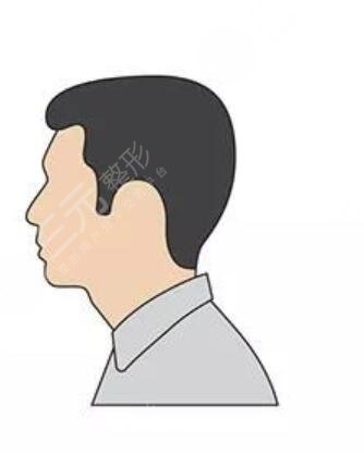 合肥曙光植發(fā)醫(yī)院植發(fā)靠譜嗎