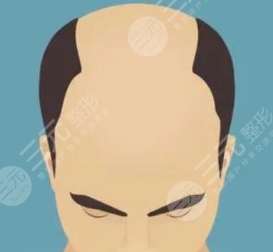 無錫雍禾醫(yī)院怎么樣