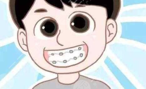 成都圣貝口腔醫(yī)院牙齒矯正案例分享