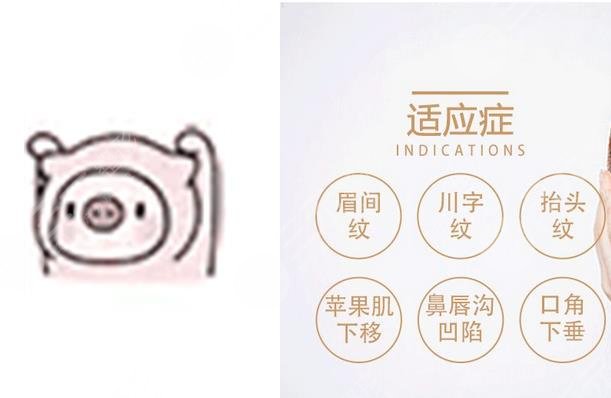 v美減齡果好不好能維持幾年?