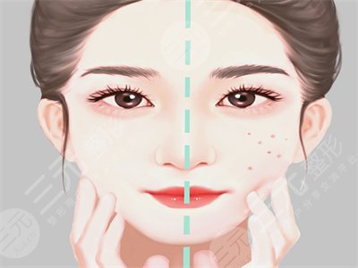 上海九院熱瑪吉做一次多少錢？價格表一覽+前后對比照片分享~