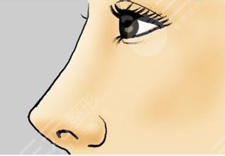 洛陽中心醫(yī)院徐永飛隆鼻案例